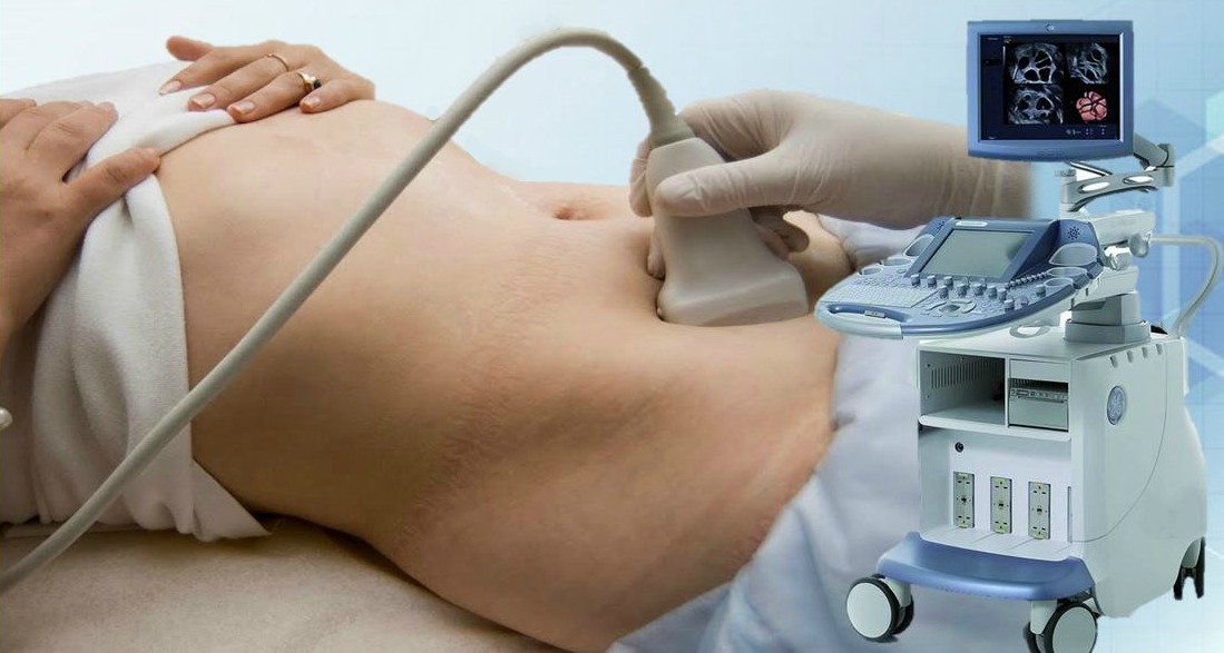 ECOGRAFIA PULSINELLI MEDICAL CENTER 1