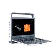 Equipo-Medico-Ultrasonido-Portatil-p30