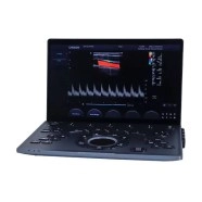 ULTRASONIDO-PORTATIL-SONOAIR-30-01